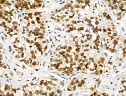 Invitrogen Phospho-NFATC1 (Ser172) Polyclonal Antibody 100 μL; Unconjugated:Antibodies,