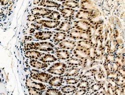 Invitrogen Phospho-NFATC1 (Ser172) Polyclonal Antibody 100 μL; Unconjugated:Antibodies,