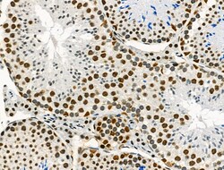 Invitrogen Phospho-NFATC1 (Ser172) Polyclonal Antibody 100 μL; Unconjugated:Antibodies,