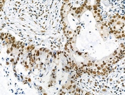 Invitrogen Phospho-NFATC1 (Ser172) Polyclonal Antibody 100 μL; Unconjugated:Antibodies,