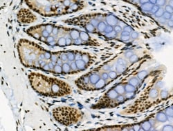 Invitrogen Phospho-NFATC1 (Ser172) Polyclonal Antibody 100 μL; Unconjugated:Antibodies,