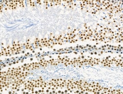 Invitrogen Phospho-NFATC1 (Ser172) Polyclonal Antibody 100 μL; Unconjugated:Antibodies,