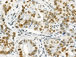 Invitrogen Phospho-NFATC1 (Ser172) Polyclonal Antibody 100 μL; Unconjugated:Antibodies,