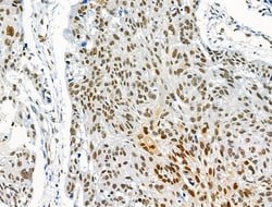 Invitrogen Phospho-NFATC1 (Ser172) Polyclonal Antibody 100 μL; Unconjugated:Antibodies,