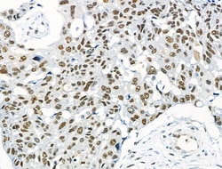 Invitrogen Phospho-NFATC1 (Ser172) Polyclonal Antibody 100 μL; Unconjugated:Antibodies,