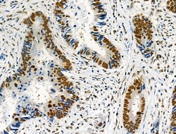 Invitrogen Phospho-NFATC1 (Ser172) Polyclonal Antibody 100 μL; Unconjugated:Antibodies,