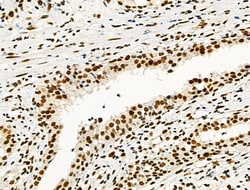Invitrogen Phospho-NFATC1 (Ser172) Polyclonal Antibody 100 μL; Unconjugated:Antibodies,