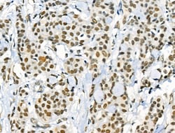 Invitrogen Phospho-NFATC1 (Ser172) Polyclonal Antibody 100 μL; Unconjugated:Antibodies,