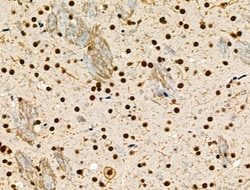 Invitrogen Phospho-NFATC1 (Ser172) Polyclonal Antibody 100 μL; Unconjugated:Antibodies,