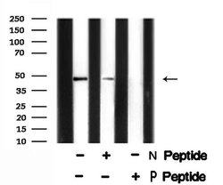 Invitrogen Phospho-PTP1B (Tyr66) Polyclonal Antibody 100 &mu;L | Buy Online | Invitrogen&trade; | Fisher Scientific