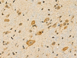 Invitrogen Phospho-S6 (Ser244) Polyclonal Antibody 100 μL; Unconjugated:Antibodies,