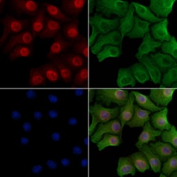 Invitrogen Phospho-SMAD4 (Thr277) Polyclonal Antibody 100 &mu;L; Unconjugated:Antibodies,