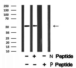 Invitrogen Phospho-NR5A1 (Ser203) Polyclonal Antibody 100 μL; Unconjugated:Antibodies,
