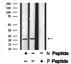 Invitrogen Phospho-STMN2 (Ser73) Polyclonal Antibody 100 &mu;L; Unconjugated:Antibodies,