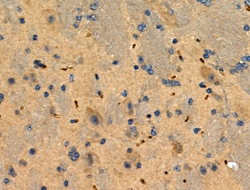 Invitrogen Phospho-STMN2 (Ser73) Polyclonal Antibody 100 &mu;L; Unconjugated:Antibodies,