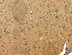Invitrogen Phospho-STMN2 (Ser73) Polyclonal Antibody 100 &mu;L; Unconjugated:Antibodies,