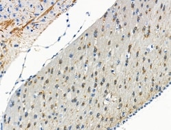 Invitrogen Phospho-Torc2 (Ser171) Polyclonal Antibody 100 μL; Unconjugated:Antibodies,