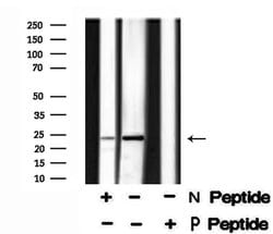 Invitrogen Phospho-TPPP (Ser18) Polyclonal Antibody 100 &mu;L | Buy Online | Invitrogen&trade; | Fisher Scientific