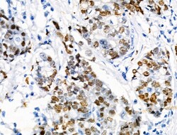 Invitrogen Phospho-TPPP (Ser18) Polyclonal Antibody 100 &mu;L | Buy Online | Invitrogen&trade; | Fisher Scientific