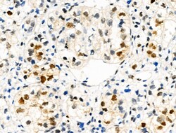 Invitrogen Phospho-TPPP (Ser18) Polyclonal Antibody 100 &mu;L | Buy Online | Invitrogen&trade; | Fisher Scientific