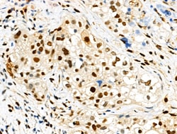 Invitrogen Phospho-TPPP (Ser18) Polyclonal Antibody 100 &mu;L | Buy Online | Invitrogen&trade; | Fisher Scientific