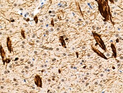 Invitrogen Phospho-TPPP (Ser18) Polyclonal Antibody 100 &mu;L | Buy Online | Invitrogen&trade; | Fisher Scientific