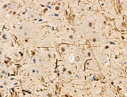 Invitrogen Phospho-TPPP (Ser18) Polyclonal Antibody 100 &mu;L | Buy Online | Invitrogen&trade; | Fisher Scientific