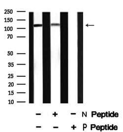 Invitrogen Phospho-USP28 (Ser67) Polyclonal Antibody 100 μL; Unconjugated:Antibodies,