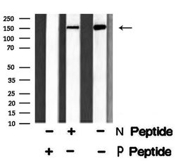 Invitrogen Phospho-ALK (Tyr1586) Polyclonal Antibody 100 &mu;L; Unconjugated:Antibodies,
