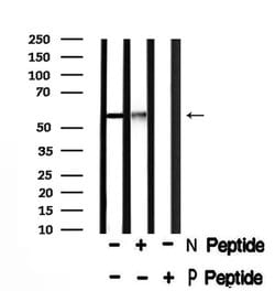 Invitrogen Phospho-PFKFB2 (Ser466) Polyclonal Antibody 100 &mu;L; Unconjugated:Antibodies,