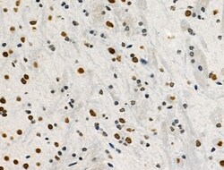 Invitrogen Phospho-POLR2A (Ser1616) Polyclonal Antibody 100 μL; Unconjugated:Antibodies,