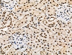 Invitrogen Phospho-POLR2A (Ser1616) Polyclonal Antibody 100 μL; Unconjugated:Antibodies,