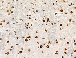 Invitrogen Phospho-POLR2A (Ser1616) Polyclonal Antibody 100 μL; Unconjugated:Antibodies,