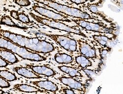 Invitrogen Phospho-POLR2A (Ser1616) Polyclonal Antibody 100 μL; Unconjugated:Antibodies,