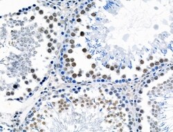 Invitrogen Phospho-POLR2A (Ser1616) Polyclonal Antibody 100 μL; Unconjugated:Antibodies,