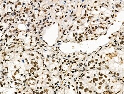 Invitrogen Phospho-POLR2A (Ser1616) Polyclonal Antibody 100 μL; Unconjugated:Antibodies,