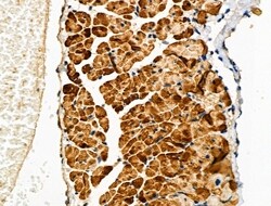 Phospho-Cardiac Troponin I (Ser23, Ser24) Polyclonal Antibody, Invitrogen
