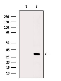 Phospho-Cardiac Troponin I (Ser23, Ser24) Polyclonal Antibody, Invitrogen