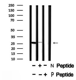 Phospho-Cardiac Troponin I (Ser23, Ser24) Polyclonal Antibody, Invitrogen