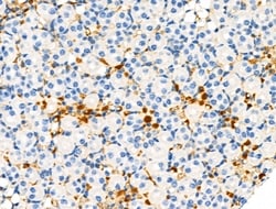 Invitrogen Phospho-TSC2 (Ser1254) Polyclonal Antibody 100 &mu;L | Buy Online | Invitrogen&trade; | Fisher Scientific