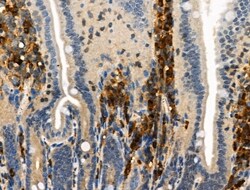 Invitrogen Phospho-TSC2 (Ser1254) Polyclonal Antibody 100 &mu;L | Buy Online | Invitrogen&trade; | Fisher Scientific