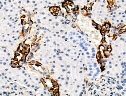 Invitrogen Phospho-TSC2 (Ser1254) Polyclonal Antibody 100 &mu;L | Buy Online | Invitrogen&trade; | Fisher Scientific