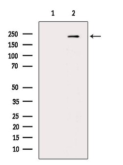 Invitrogen Phospho-TSC2 (Ser1254) Polyclonal Antibody 100 &mu;L | Buy Online | Invitrogen&trade; | Fisher Scientific