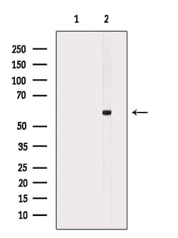 Invitrogen Phospho-AKT1 (Ser473, Tyr474) Polyclonal Antibody 100 &mu;L;