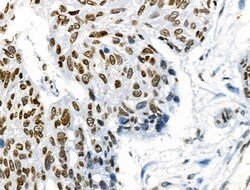 Invitrogen Phospho-ABI1 (Tyr213) Polyclonal Antibody 100 &mu;L; Unconjugated:Antibodies,