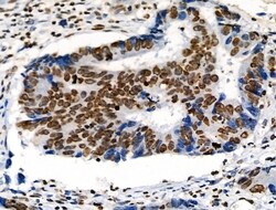Invitrogen Phospho-ABI1 (Tyr213) Polyclonal Antibody 100 &mu;L; Unconjugated:Antibodies,