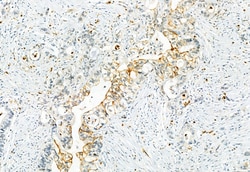 Invitrogen Phospho-CaV1.2 (Ser1981) Polyclonal Antibody 100 μL; Unconjugated:Antibodies,