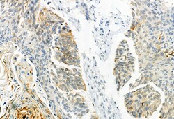 Invitrogen Phospho-CaV1.2 (Ser1981) Polyclonal Antibody 100 μL; Unconjugated:Antibodies,