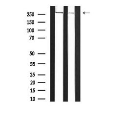 Invitrogen Phospho-CaV1.2 (Ser1981) Polyclonal Antibody 100 μL; Unconjugated:Antibodies,