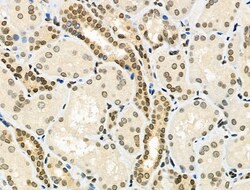 Invitrogen Phospho-E2F1 (Ser364) Polyclonal Antibody 100 &mu;L | Buy Online | Invitrogen&trade; | Fisher Scientific